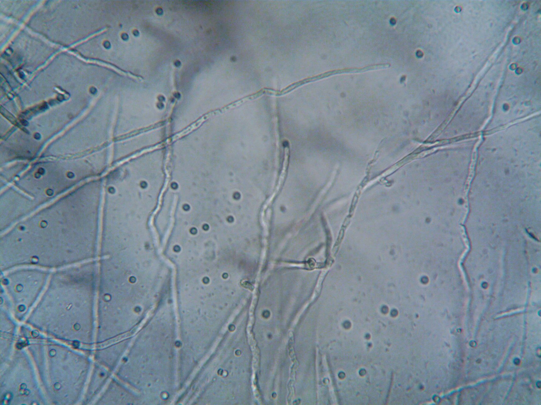 Close-up image of fungal hyphae and spores under a microscope, showcasing microbiological structures.